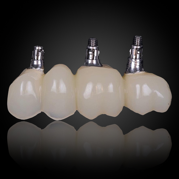 Cemented Implant Crown & Bridge