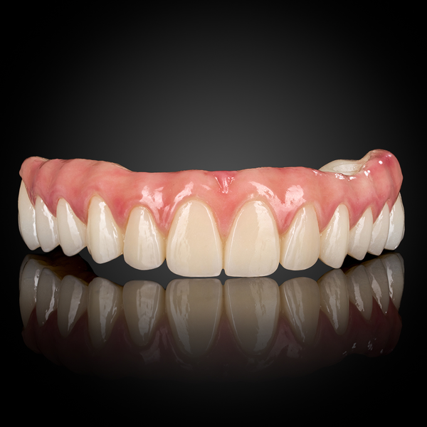 Full Arch Implant