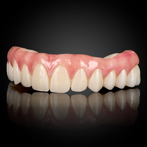 Full Arch Implant