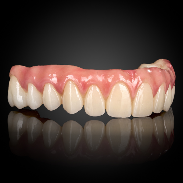 Full Arch Implant