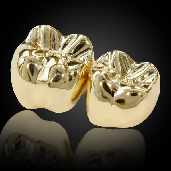 Full Cast Gold Crown