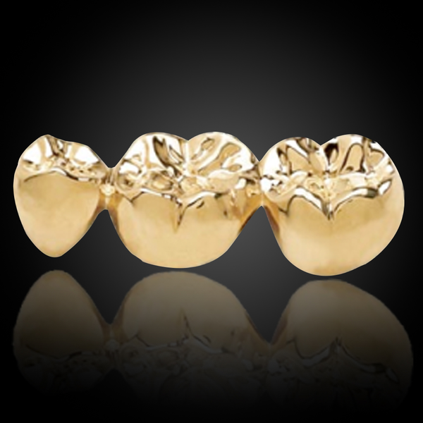 Full Cast Gold Crown