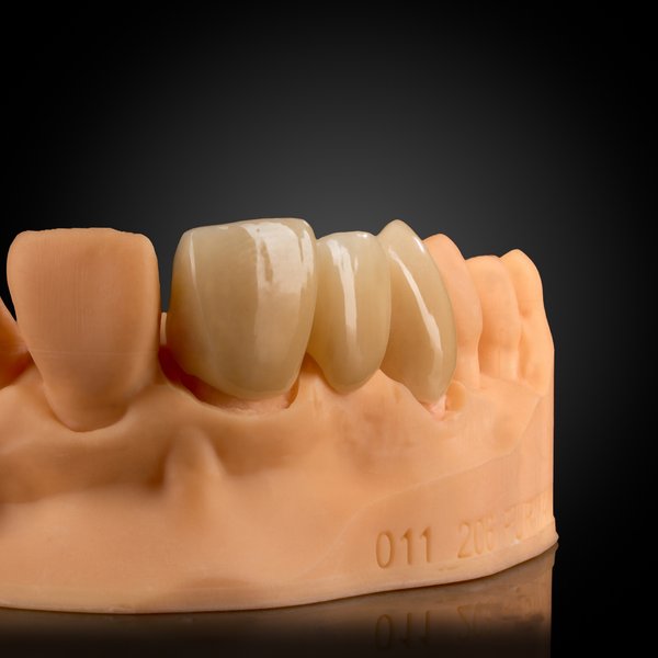 Layered Zirconia
