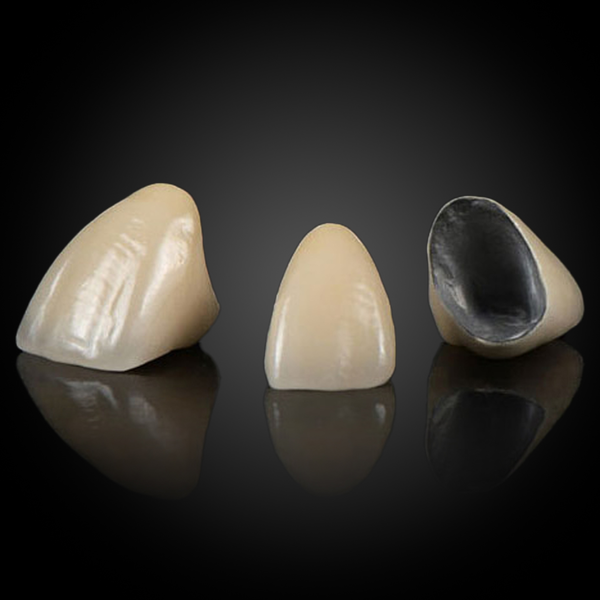 PFM (Base Metal Alloy)