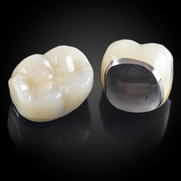 PFM (Base Metal Alloy)