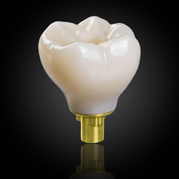 Screw-Retained Implant Crown & Bridge