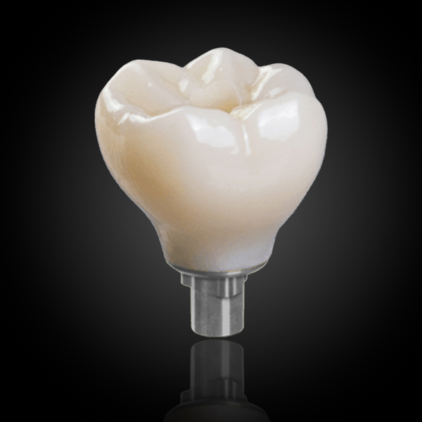 Screw-Retained Implant Crown & Bridge