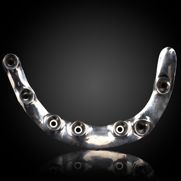 Full Arch Implant Prosthesis