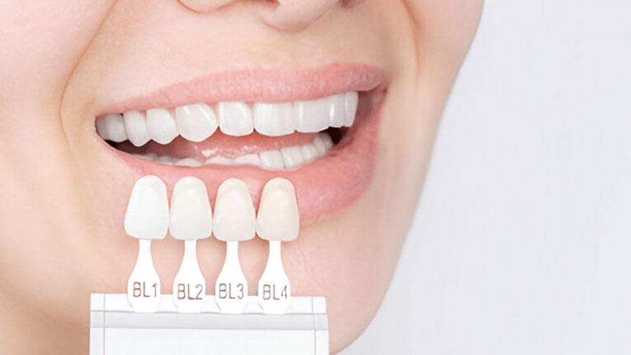 dental-lab-outsourcing-key-trends-for-2025