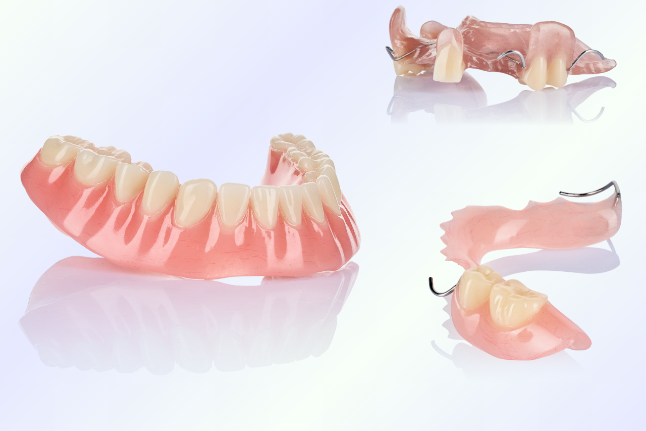 Acrylic Removable Partial Denture