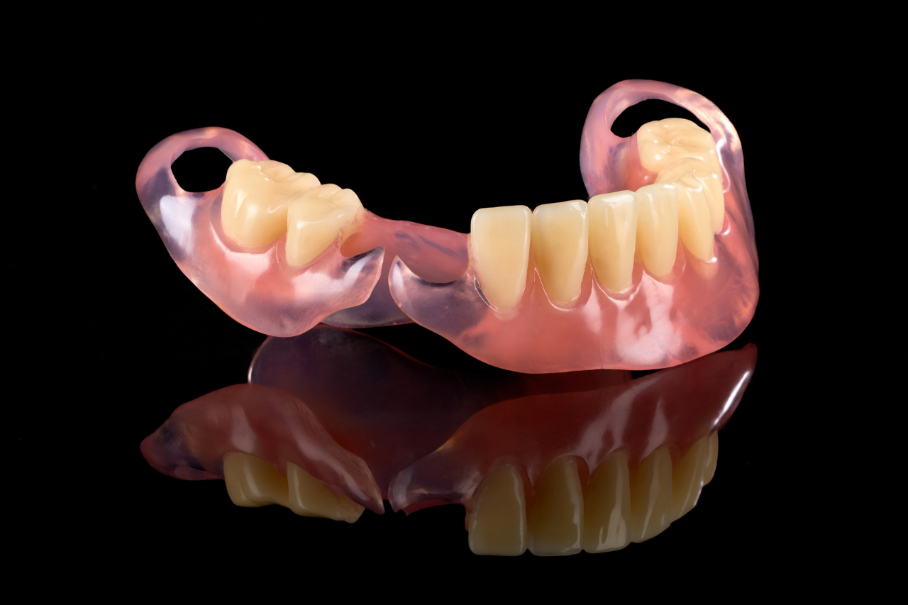 Partial Denture