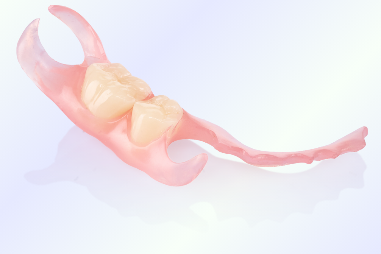 Flexible RPD