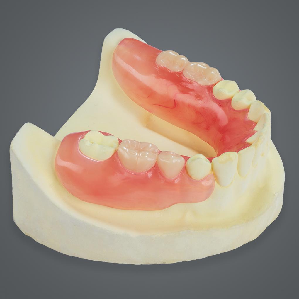Partial Denture