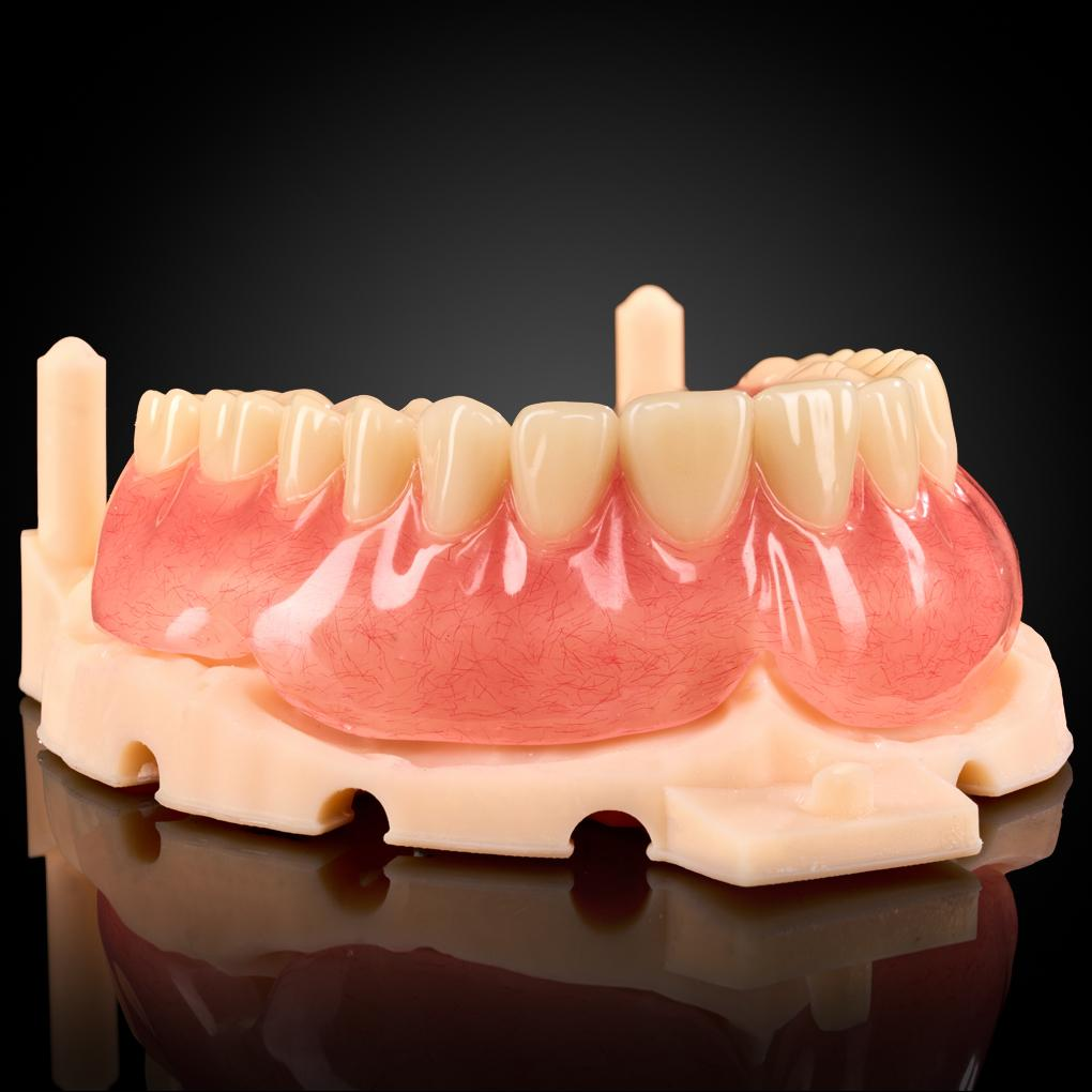 健康・医学 Best Denture Design Adsorptive-Dentures-Most-Cost-