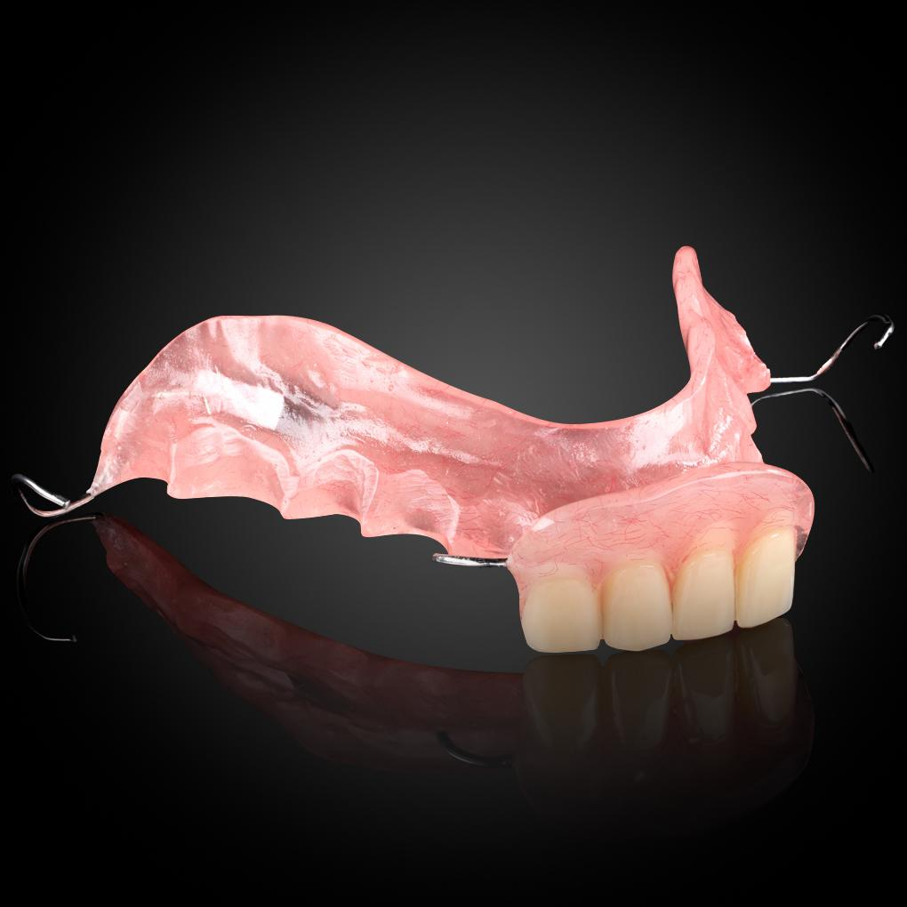 Phục Hình Tháo Lắp Tạm - Stay Plate