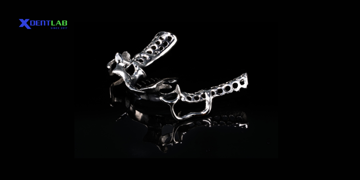 metal-frame-partial-dentures metal-frame-partial-dentures
