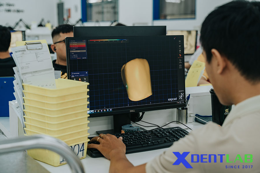 The Rise of Smart Dental Milling Technology The Rise of Smart Dental Milling Technology
