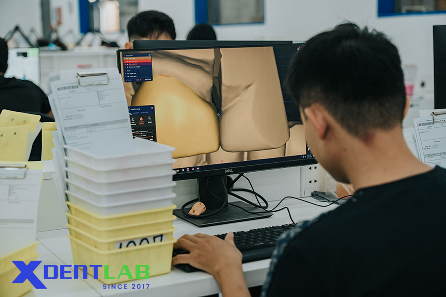 Introduction of CAD/CAM Technology