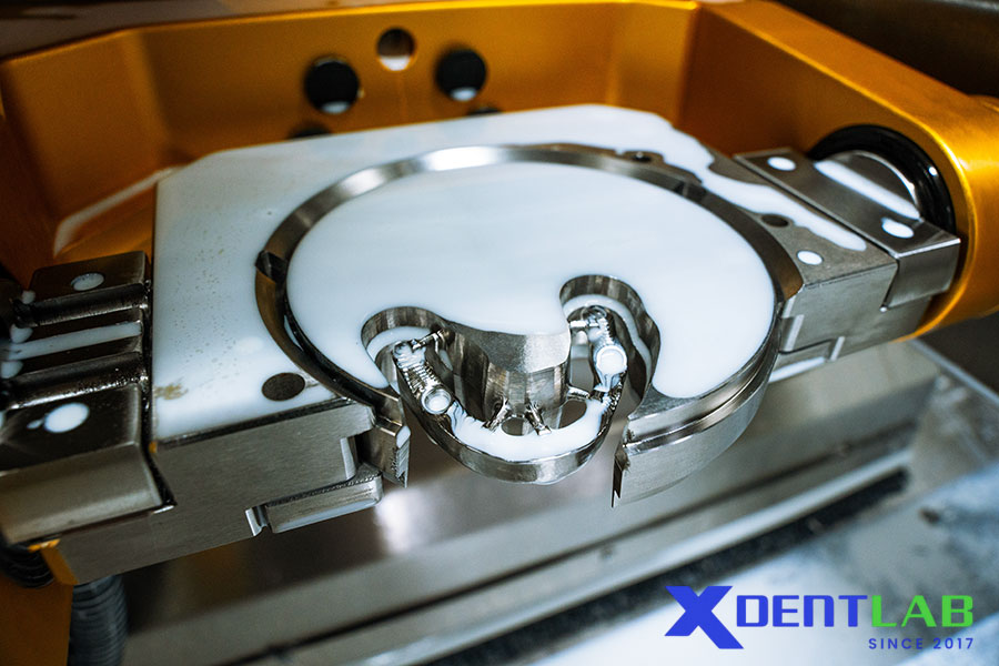 For dental labs, CAD/CAM did more than replace manual steps