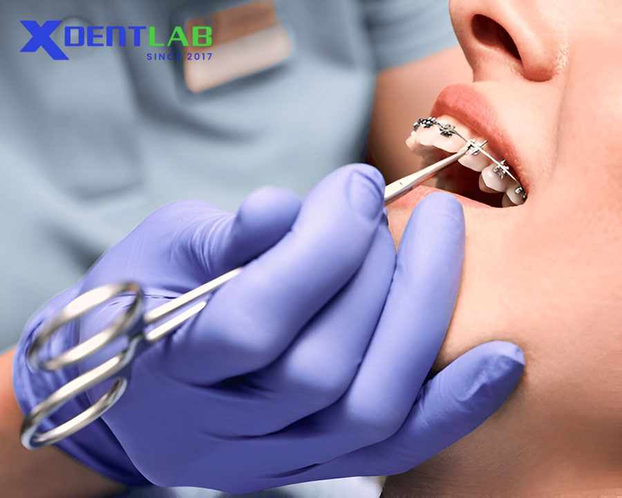 Clinical Applications in Orthodontics Clinical Applications in Orthodontics