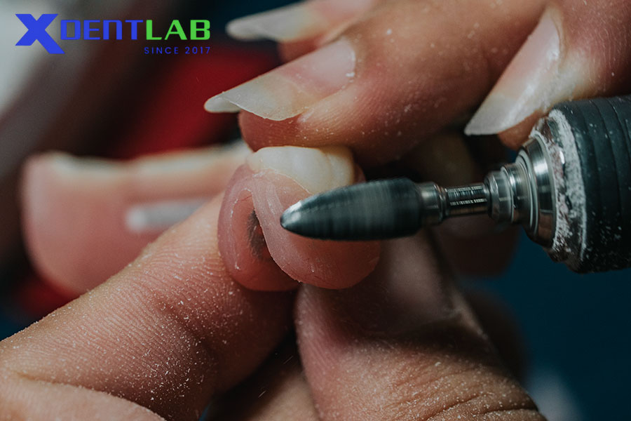 Hiểu đúng về các nguy cơ nhiễm bệnh trong labo Hiểu đúng về các nguy cơ nhiễm bệnh trong labo