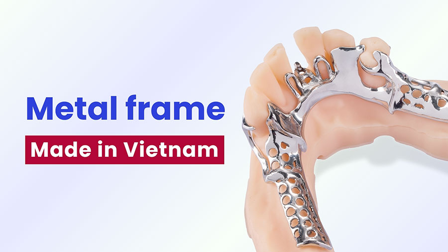 Cobalt Chrome Partials Using SLM Technology