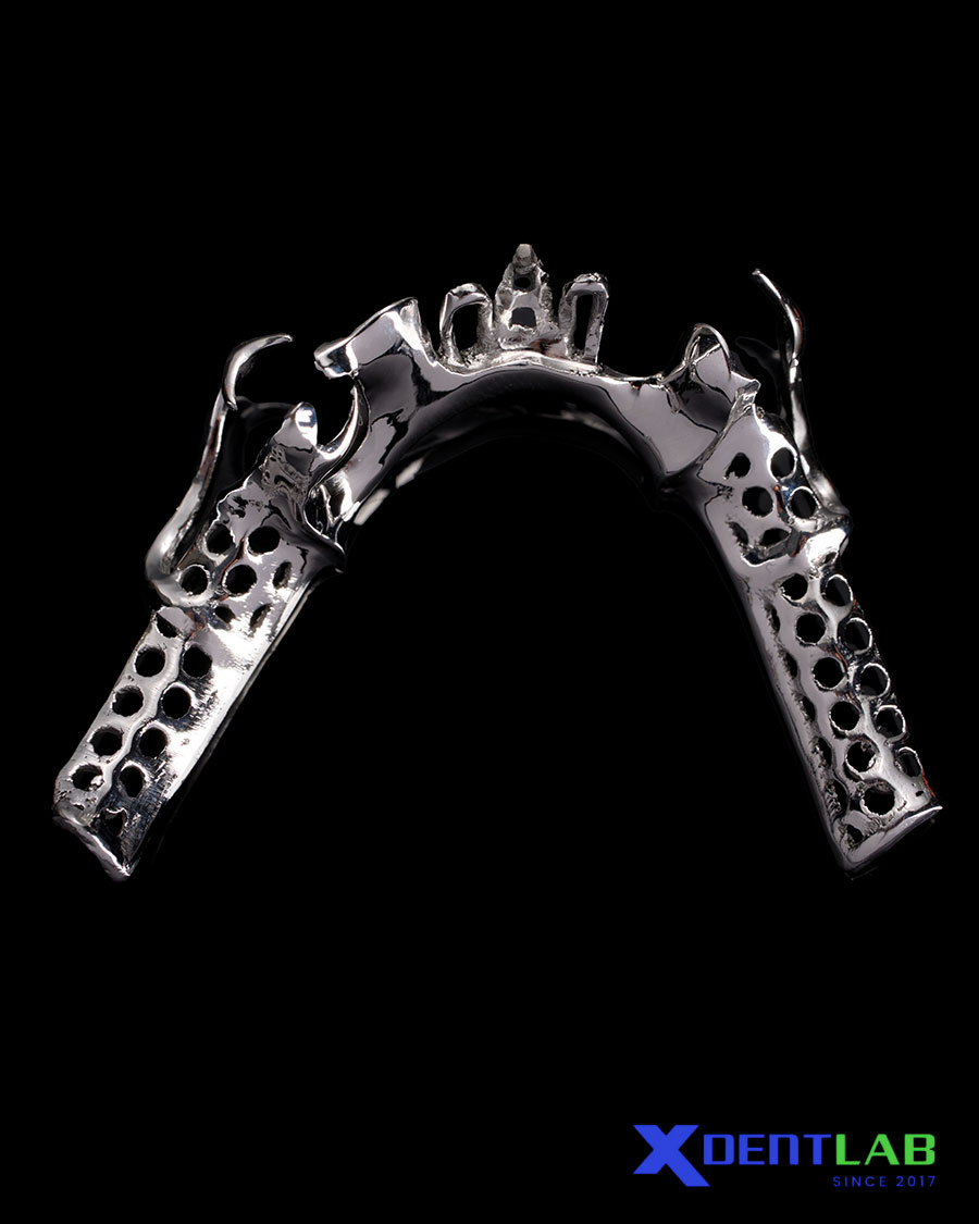 Why Cobalt Chrome Partials Still Matter