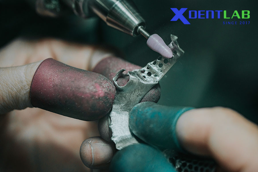 Advantages of SLM for Cobalt Chrome Partials