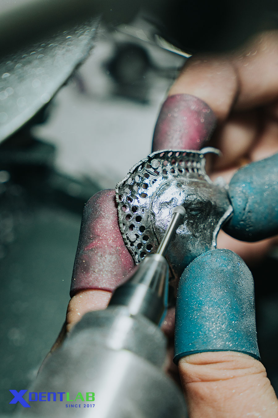 Selective Laser Melting represents one of the most meaningful technological shifts in the evolution of cobalt-chrome partial denture fabrication