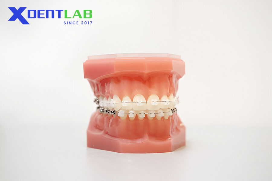 Đặc Điểm Hiệu Quả Lâm Sàng Đặc Điểm Hiệu Quả Lâm Sàng