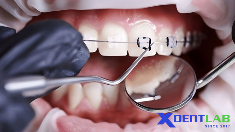 Hiệu Năng Lâm Sàng Hiệu Năng Lâm Sàng