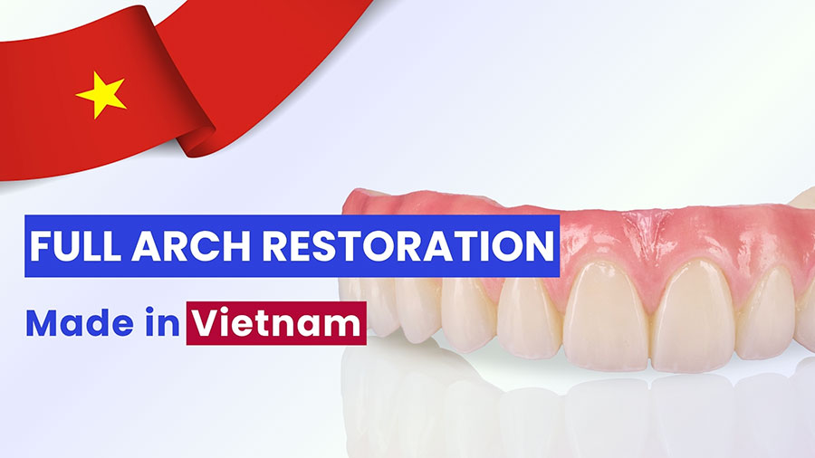 Sản Xuất Phục Hình Toàn Hàm Từ Phòng Lab Việt Nam