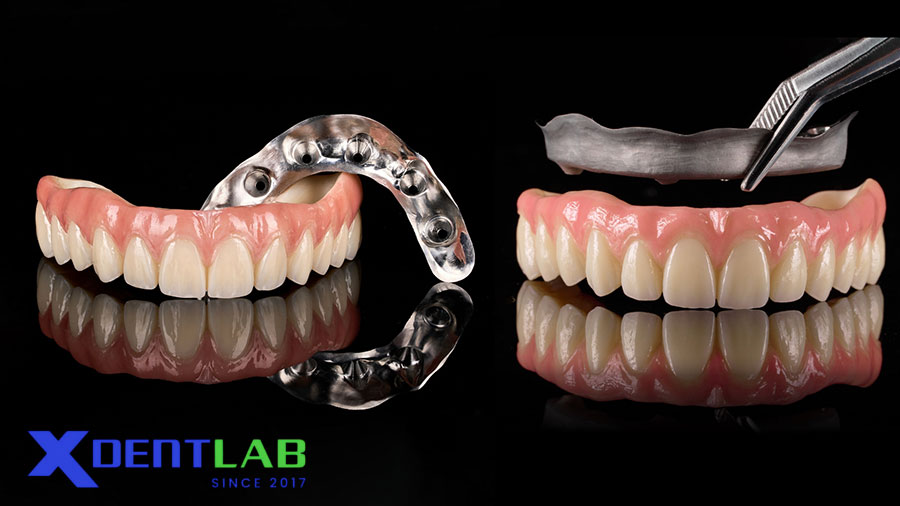 Sản Xuất Phục Hình Toàn Hàm Từ Phòng Lab Việt Nam Sản Xuất Phục Hình Toàn Hàm Từ Phòng Lab Việt Nam