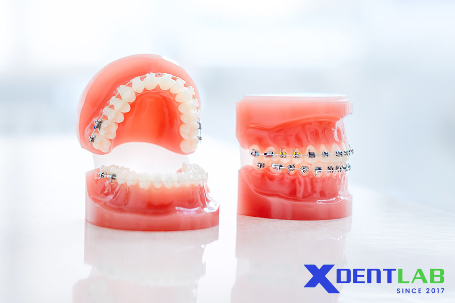 Đặc Tính Quang Học và Thẩm Mỹ