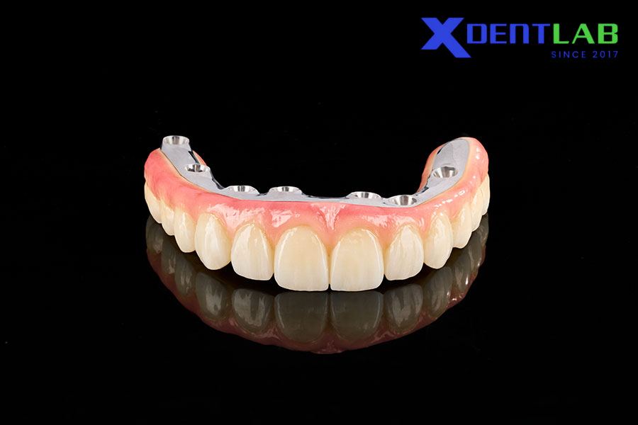 Lựa chọn vật liệu trong phục hình toàn hàm trên implant Lựa chọn vật liệu trong phục hình toàn hàm trên implant