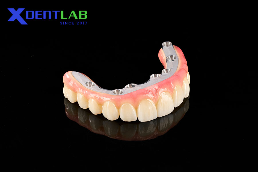 Tại sao việc chọn vật liệu quyết định thành công trong phục hình toàn hàm trên implant Tại sao việc chọn vật liệu quyết định thành công trong phục hình toàn hàm trên implant