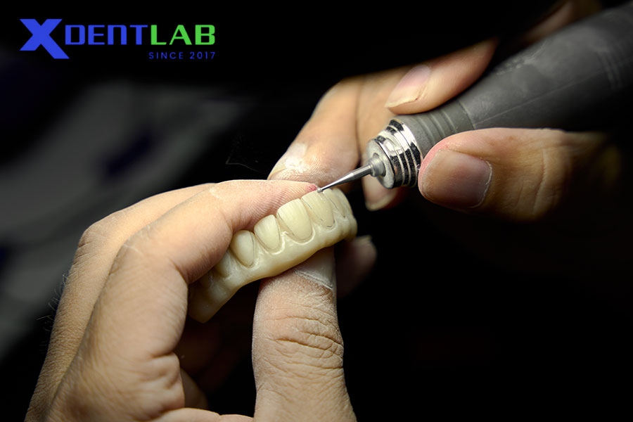 Bác sĩ hay kỹ thuật viên – Ai là người quyết định vật liệu? Bác sĩ hay kỹ thuật viên – Ai là người quyết định vật liệu?