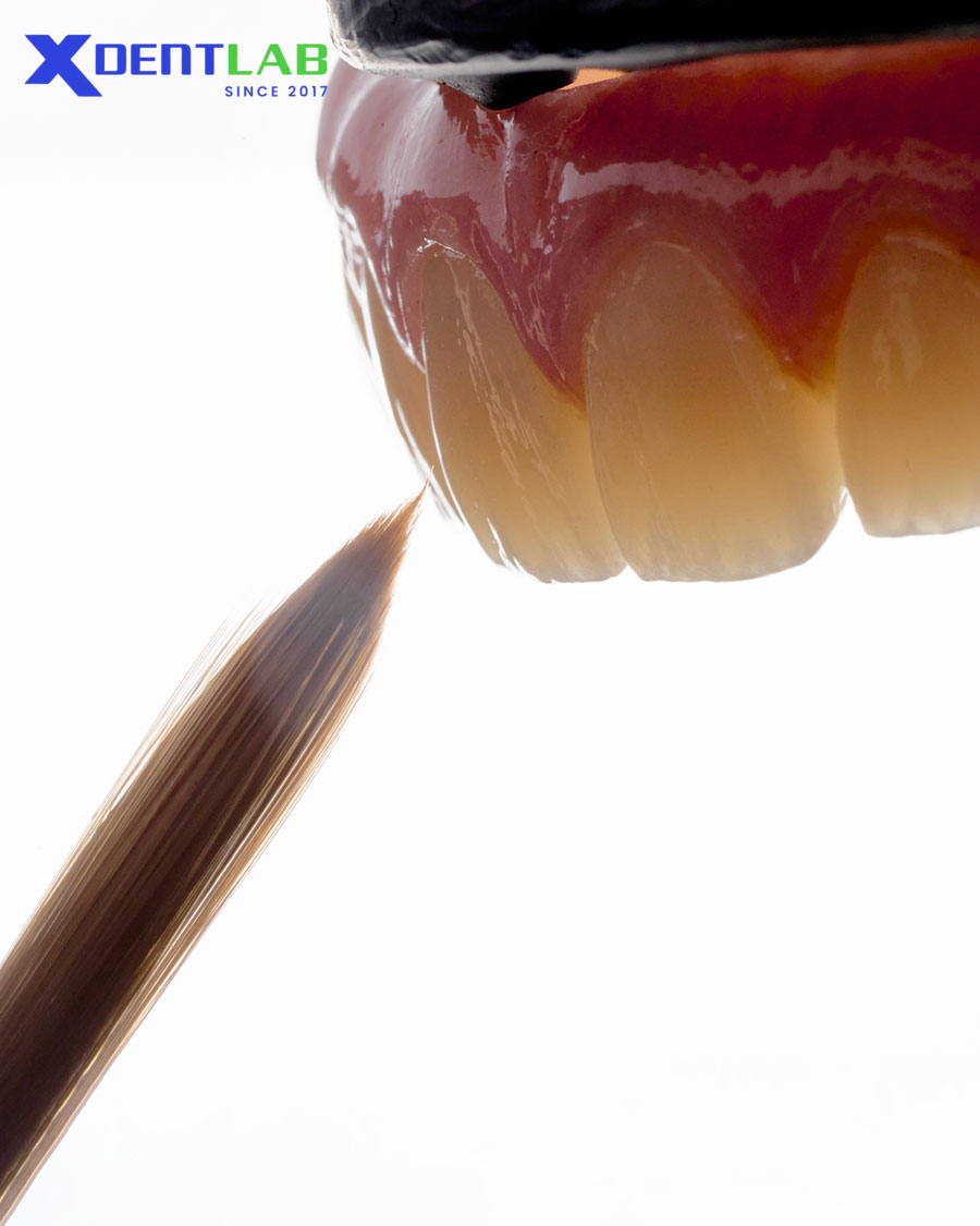 Cách chọn vật liệu phù hợp cho phục hình toàn hàm trên implant Cách chọn vật liệu phù hợp cho phục hình toàn hàm trên implant