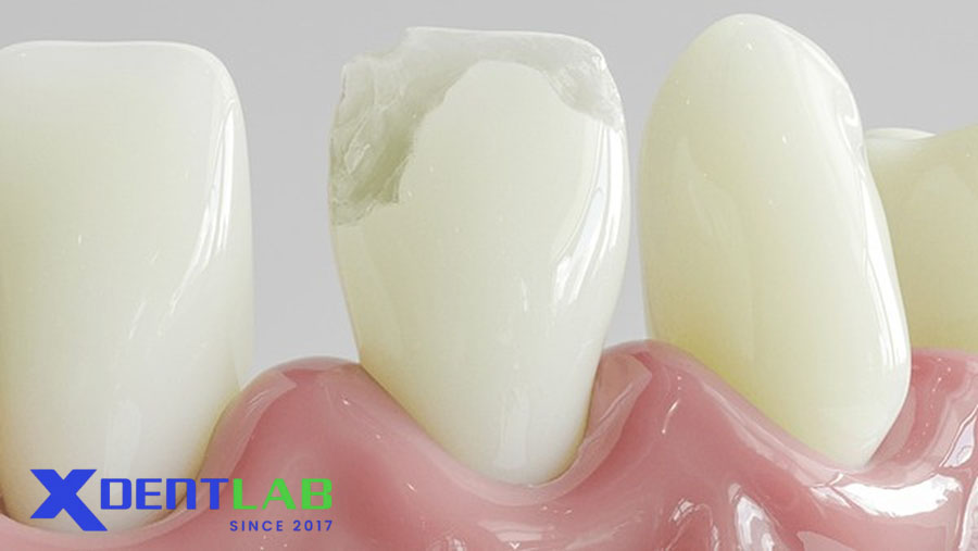 Fluoride-Based Materials