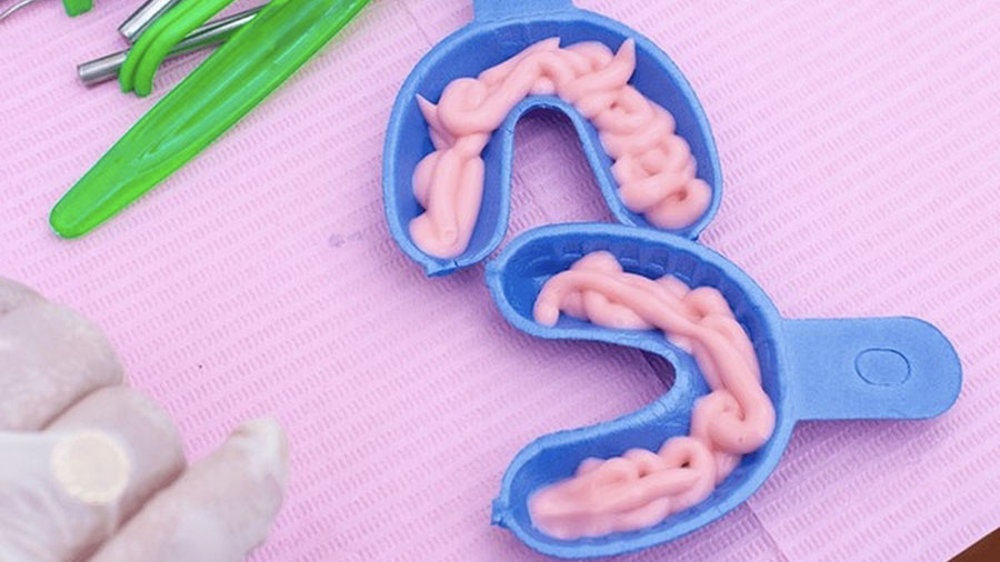 Vật Liệu Dự Phòng Chứa Fluoride: Tổng Quan Học Thuật & Đổi Mới Công Nghệ