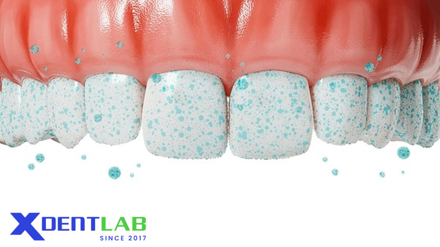 Ưu Điểm Và Hạn Chế Ưu Điểm Và Hạn Chế