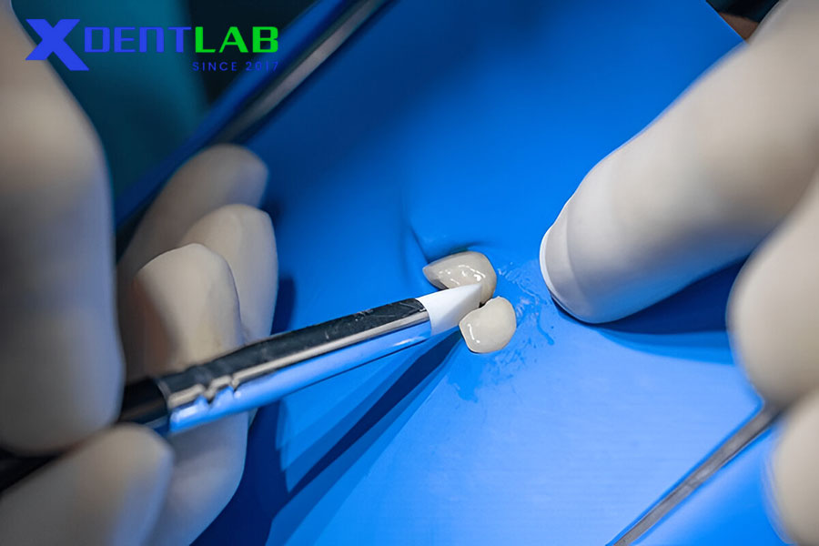 Clinical Decision Making