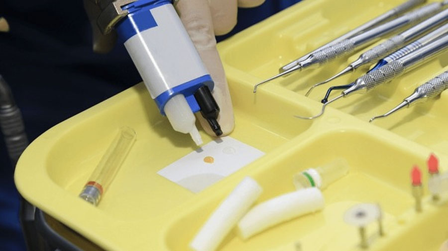 Xi Măng Glass Ionomer: Cuộc Cách Mạng Trong Chăm Sóc Dự Phòng Chứa Fluoride