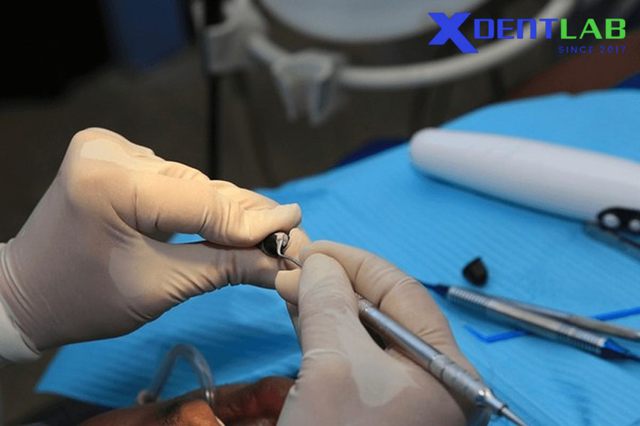 Hiệu Quả Dự Phòng Và Ứng Dụng Lâm Sàng Hiệu Quả Dự Phòng Và Ứng Dụng Lâm Sàng