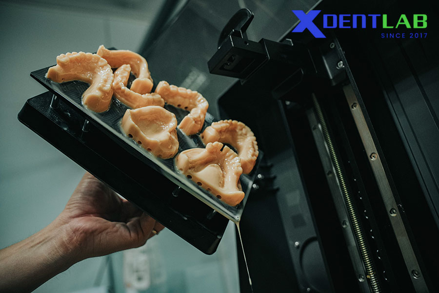 Why Multi-Material Capability Matters in Dental 3D Printing