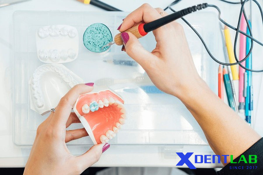 Các Loại Nhựa Trám Bít