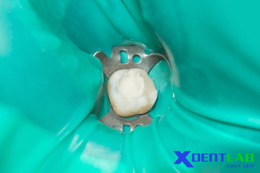 Kỹ Thuật Lâm Sàng