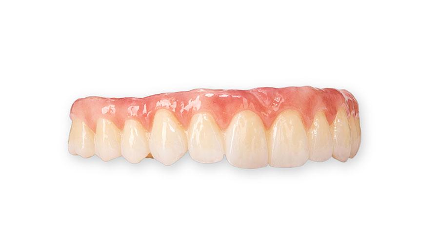 Cầu răng sứ (Dental Bridge) Cầu răng sứ (Dental Bridge)