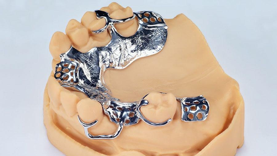 Metal Partial Dentures And Other Types Of Partials