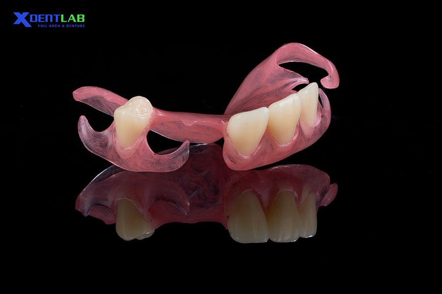 Flexible Partial Denture has the main component of flexible plastic (Valplast) Flexible Partial Denture has the main component of flexible plastic (Valplast)